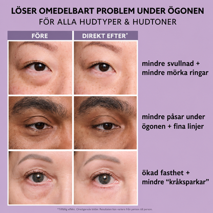 Thomas Roth - Instant Eye Firmer