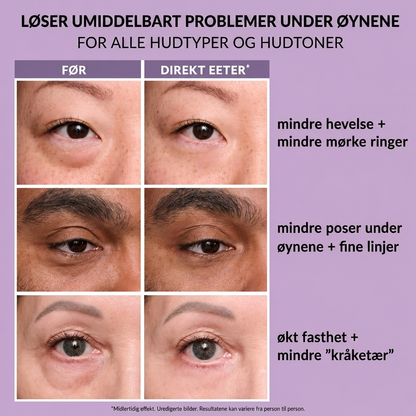 Thomas Roth - Instant Eye Tightner