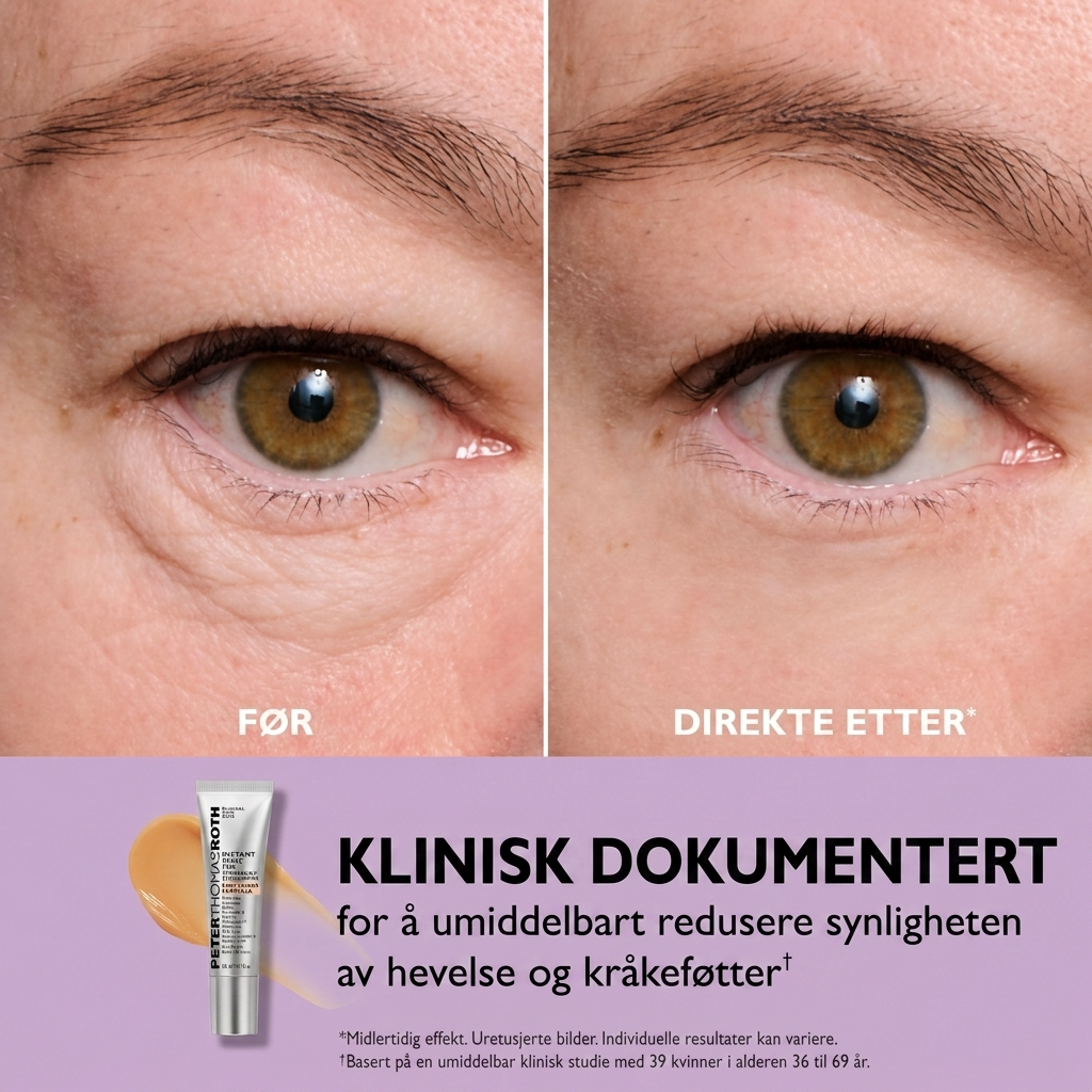 Thomas Roth - Instant Eye Tightner