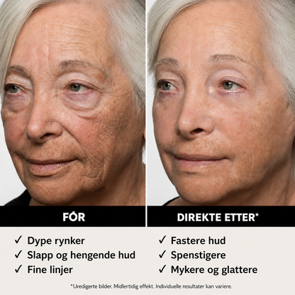 Thomas Roth Instant Face Tightner
