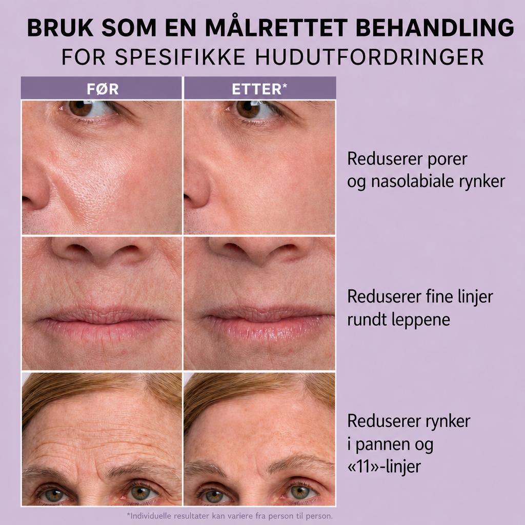 Thomas Roth Instant Face Tightner