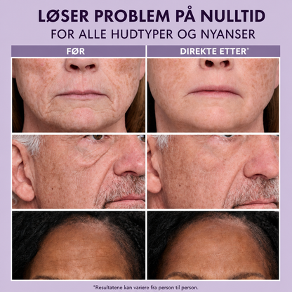 Thomas Roth Instant Face Tightner